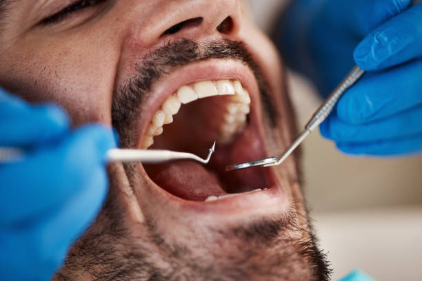 Best Pediatric Emergency Dentist in Marion, VA